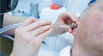 Assessing Whether Professional Ear Wax Removal is Right for You